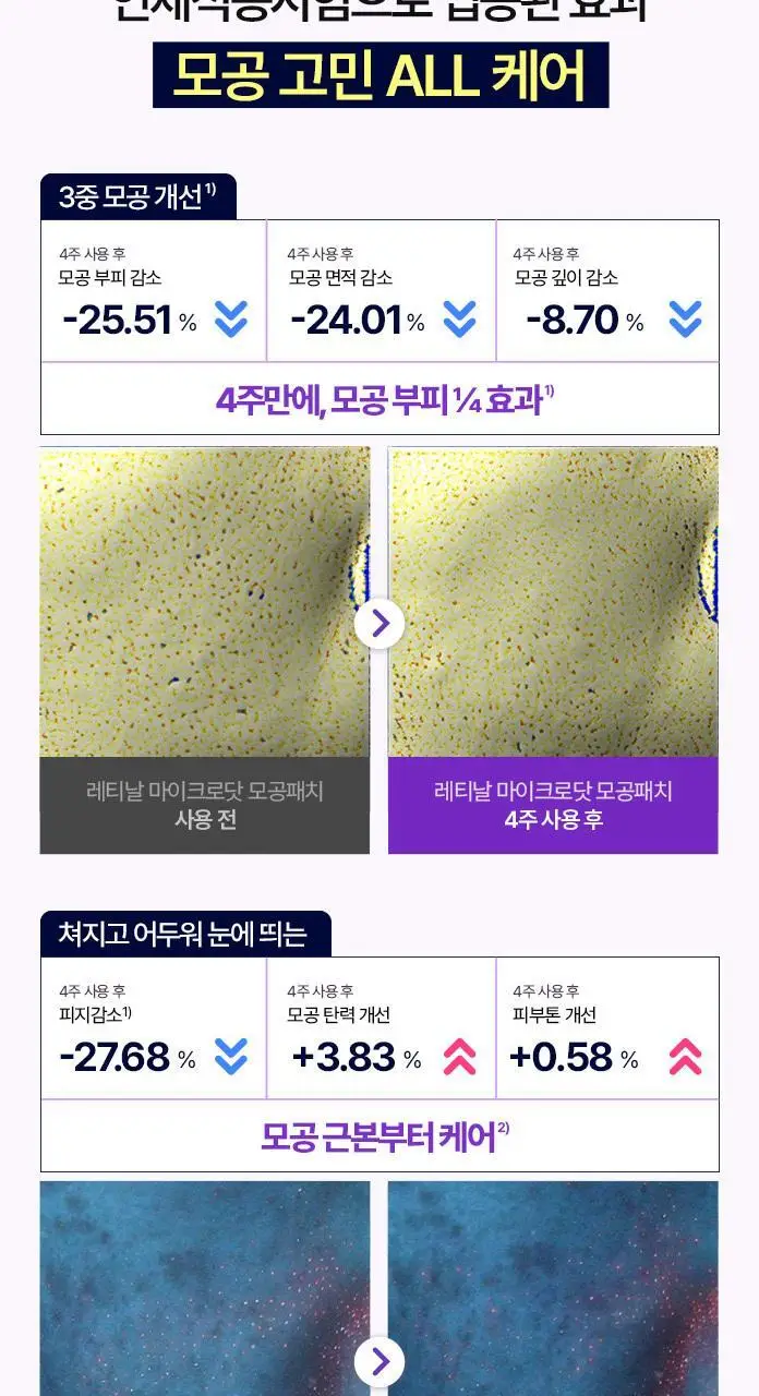 [맞춤형집중패치] 케어플러스 마이크로 닷 패치 3종 [징크트러블/글루타치온미백/레티날모공] 연합 상세페이지 39